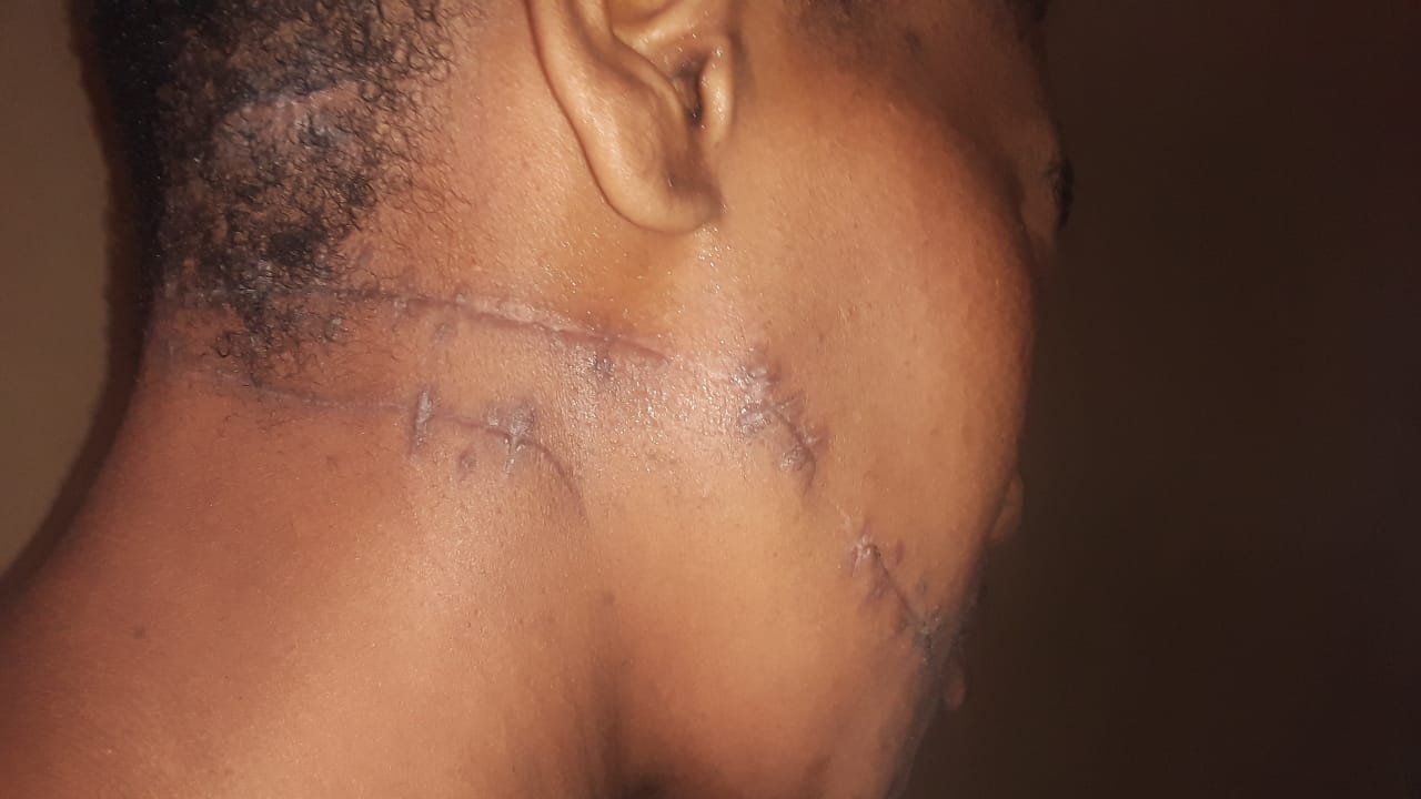 Ennerdale woman resists abuse, launches appeal against abusive husband’s bail